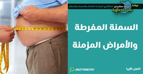 السمنة المفرطة سبب غالبية الأمراض